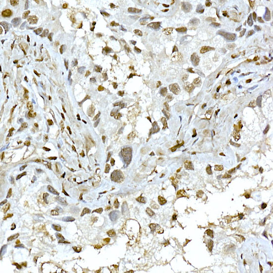 Anti-AKT1 Rabbit pAb