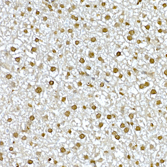 Anti-AKT1 Rabbit pAb
