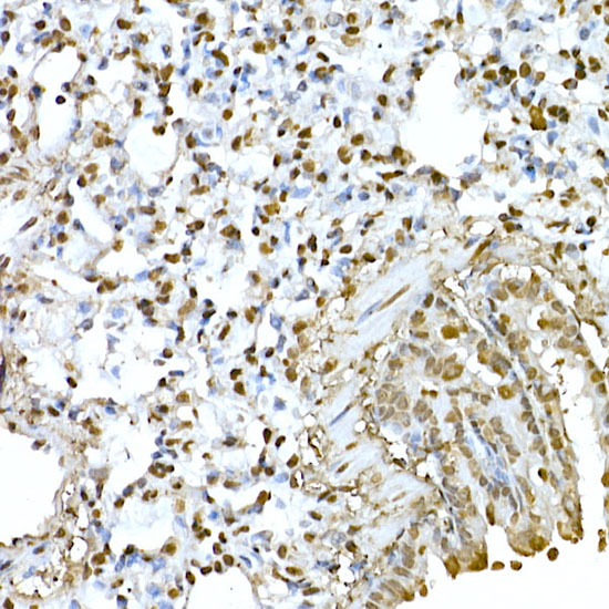 Anti-AKT1 Rabbit pAb