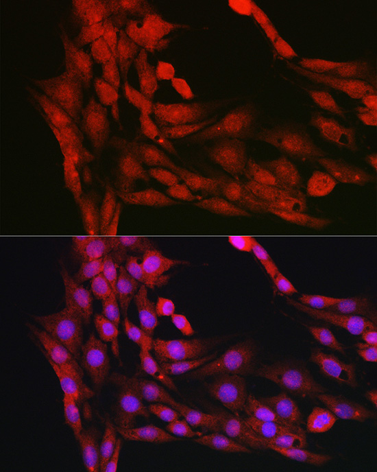 Anti-AKT1 Rabbit pAb