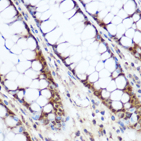 Anti-Cyclin D1 Rabbit pAb