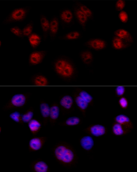 Anti-Cyclin D1 Rabbit pAb