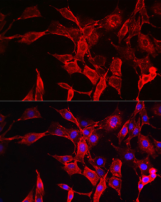 Anti-STAT3 Rabbit pAb