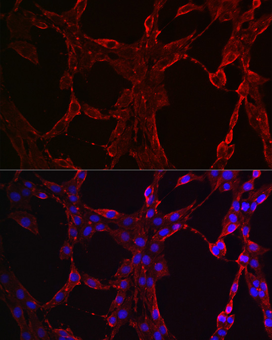 Anti-STAT3 Rabbit pAb