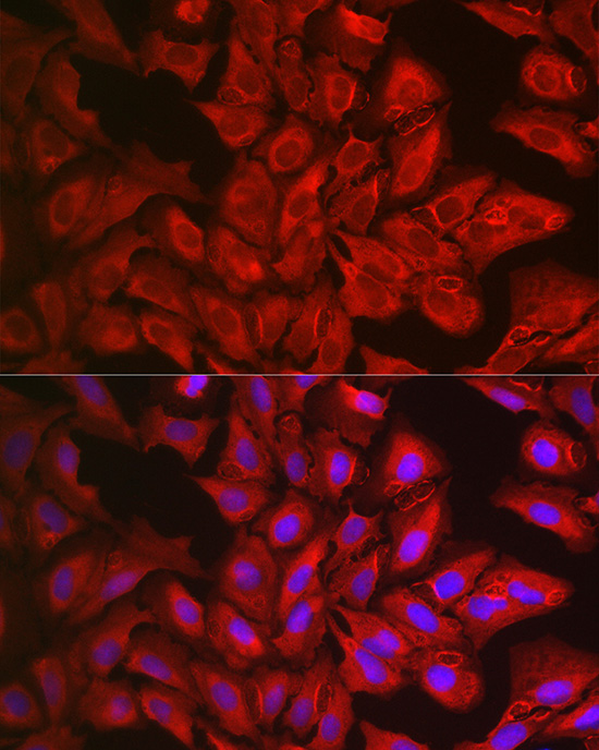 Anti-STAT3 Rabbit pAb