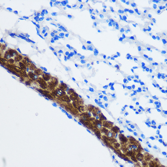 Anti-PP1C beta Rabbit pAb