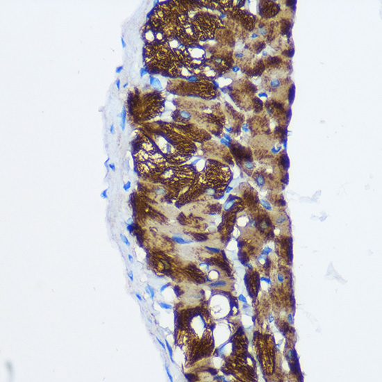 Anti-PP1C beta Rabbit pAb