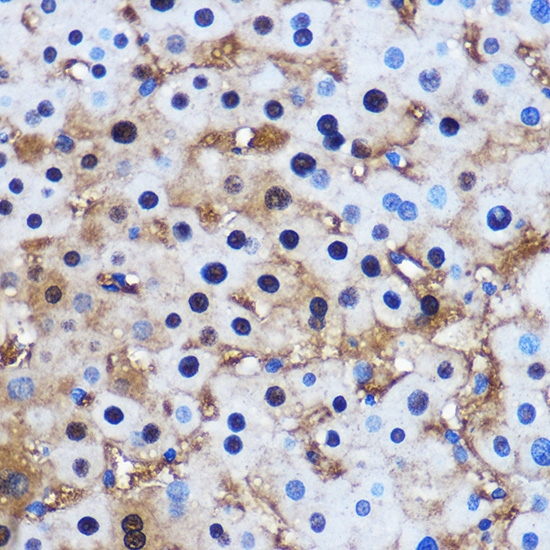 Anti-PP1C beta Rabbit pAb
