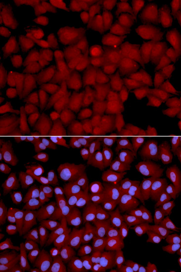 Anti-PP1C beta Rabbit pAb