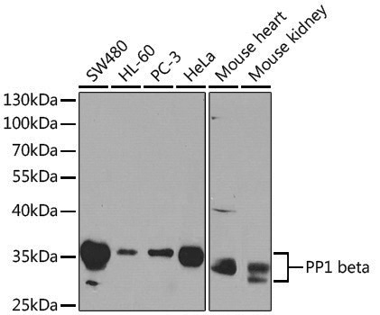 Anti-PP1C beta Rabbit pAb