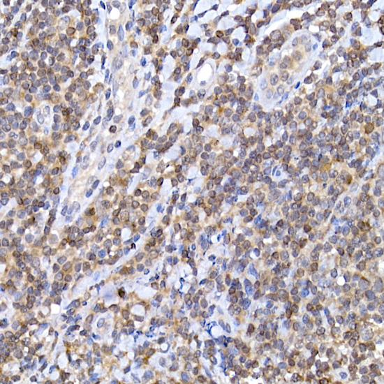 Anti-BCL2 Rabbit pAb