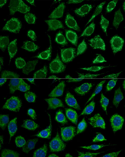 Anti-BCL2 Rabbit pAb