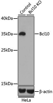 [KO Validated] Anti-Bcl10 Rabbit pAb