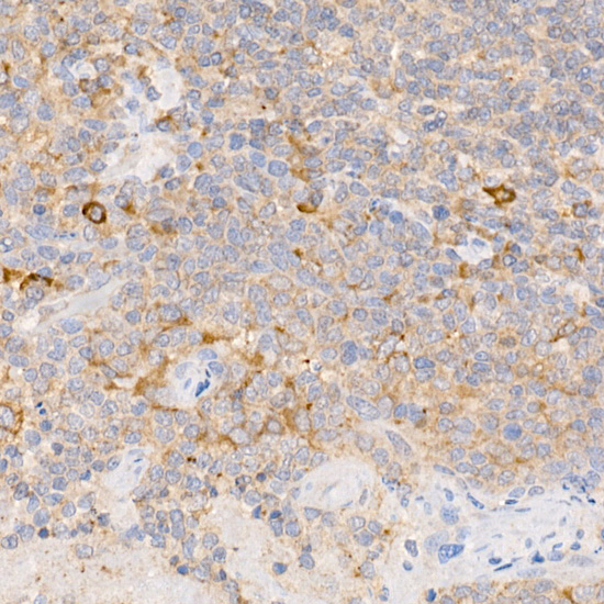 Anti-MYDGF/C19orf10 Rabbit pAb