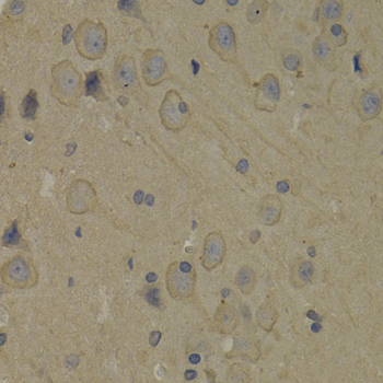 Anti-PI3 Kinase p85 alpha Rabbit pAb