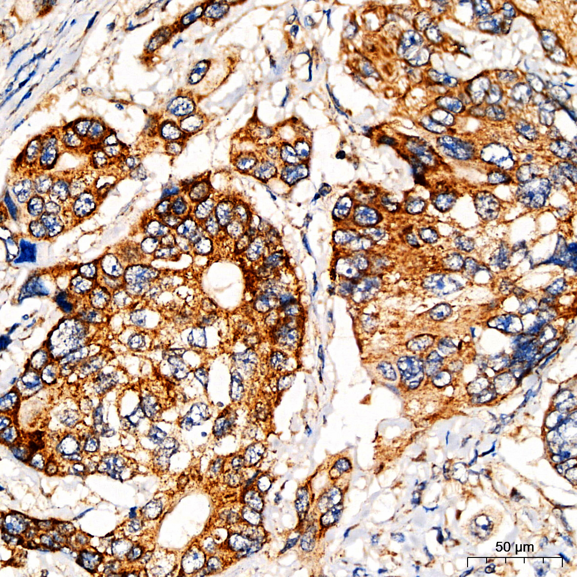 Anti-PI3 Kinase p85 alpha Rabbit pAb
