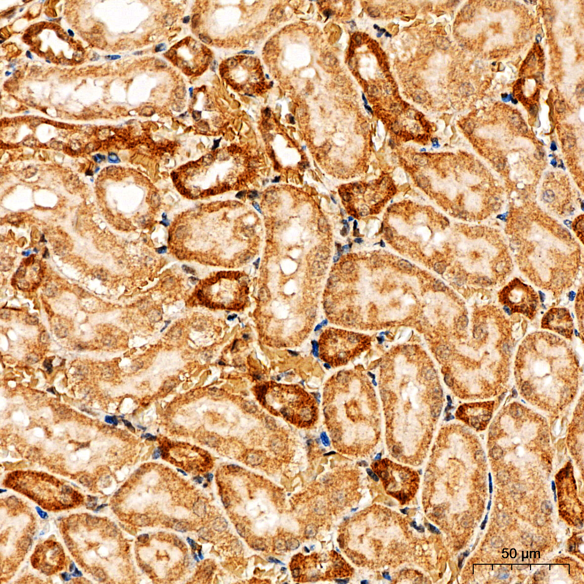 Anti-PI3 Kinase p85 alpha Rabbit pAb