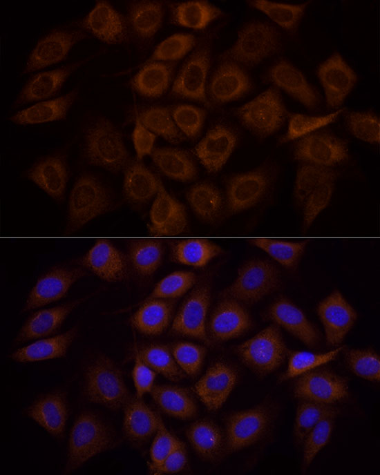 Anti-PI3 Kinase p85 alpha Rabbit pAb