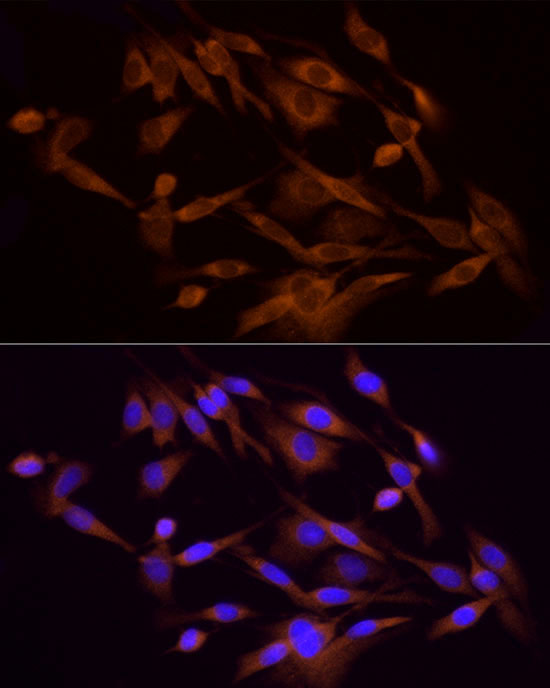 Anti-PI3 Kinase p85 alpha Rabbit pAb