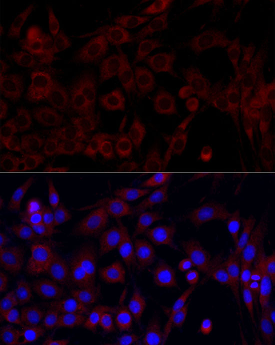 Anti-PI3 Kinase p85 alpha Rabbit pAb