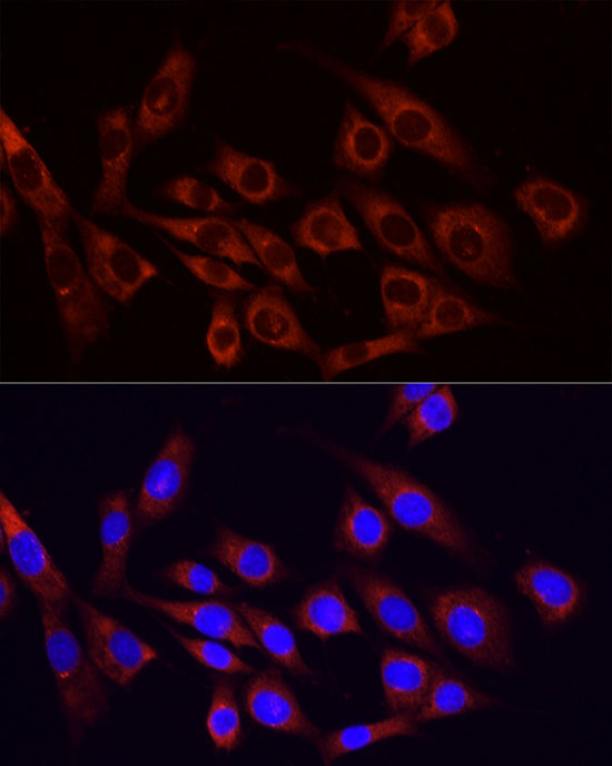 Anti-PI3 Kinase p85 alpha Rabbit pAb