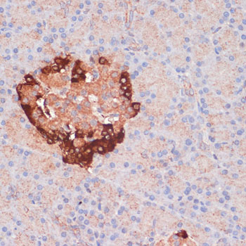 Anti-ATG5 Rabbit pAb