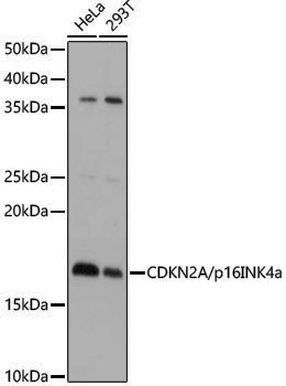 Anti-CDKN2A/p16INK4a Rabbit pAb