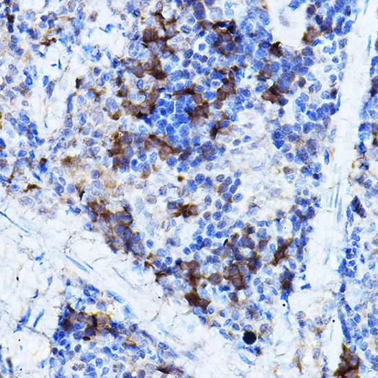 [KO Validated] Anti-ERK2 Rabbit pAb