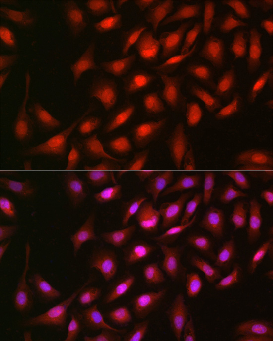 [KO Validated] Anti-ERK2 Rabbit pAb