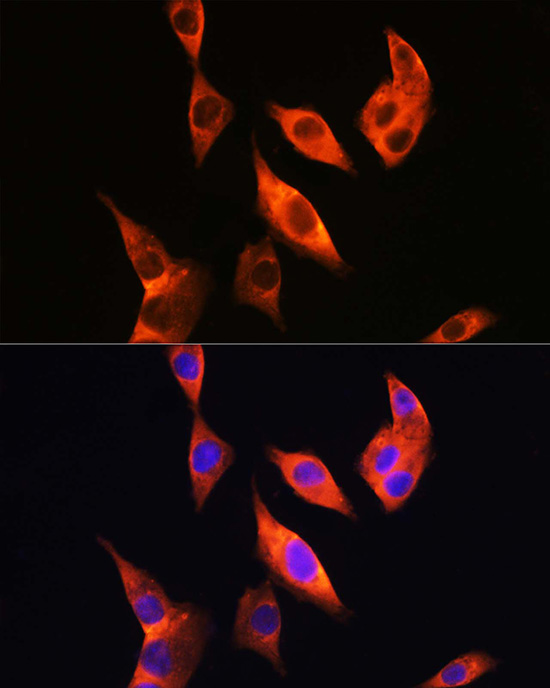 Anti-Toll-Like Receptor 4 Rabbit pAb