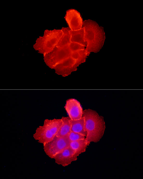 Anti-EGFR Rabbit pAb