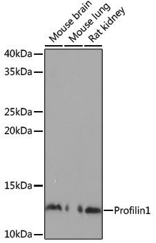 Anti-Profilin 1 Rabbit pAb