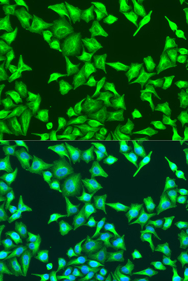 Anti-beta Catenin Rabbit pAb