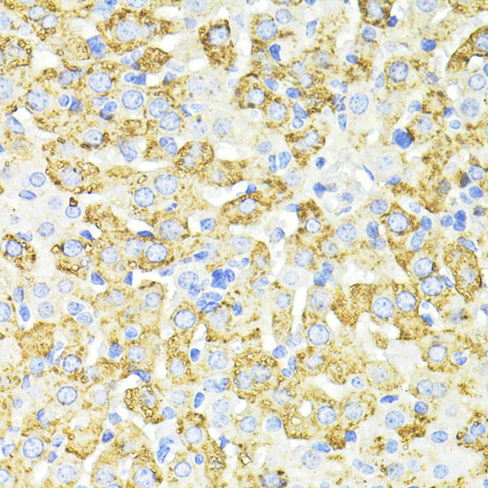 Anti-SQSTM1/p62 Rabbit pAb