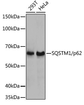 Anti-SQSTM1/p62 Rabbit pAb