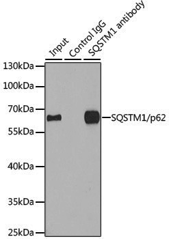 Anti-SQSTM1/p62 Rabbit pAb