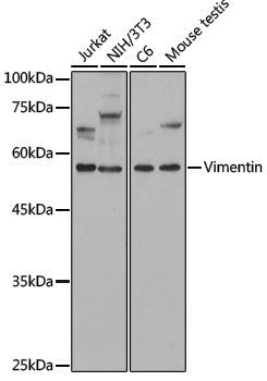[KD Validated] Anti-Vimentin Rabbit pAb