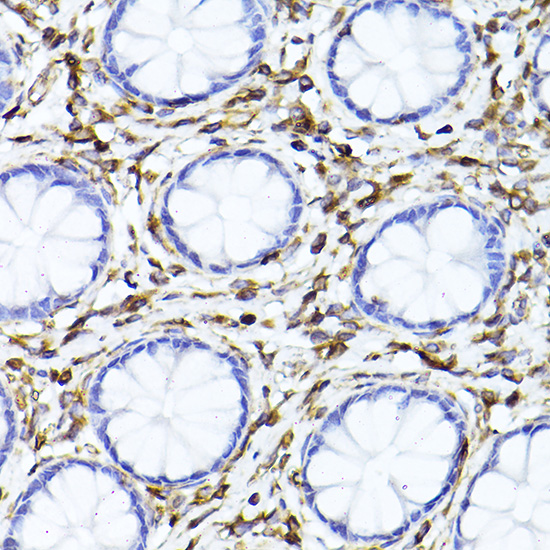 [KD Validated] Anti-Vimentin Rabbit pAb
