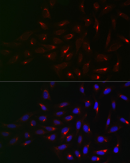 [KD Validated] Anti-Vimentin Rabbit pAb