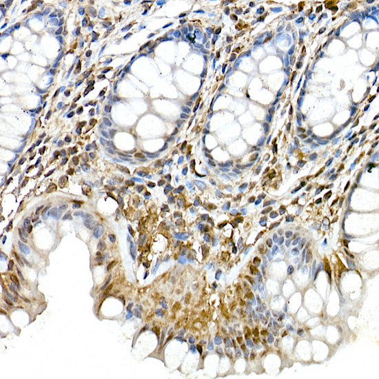 Anti-TMS1 Rabbit pAb