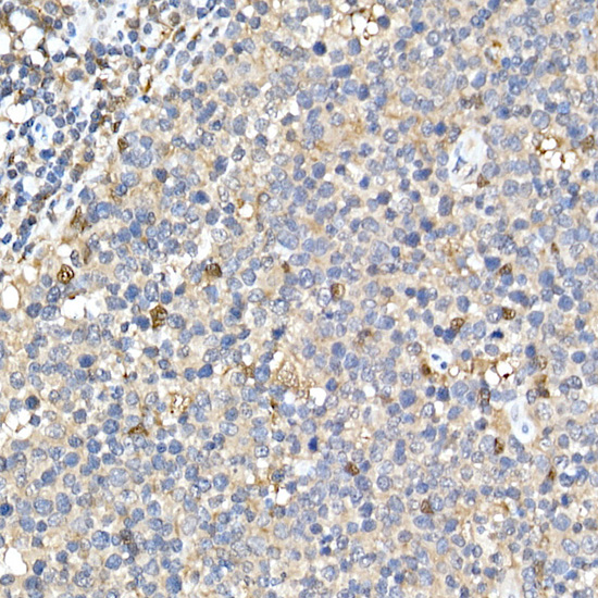 Anti-TMS1 Rabbit pAb