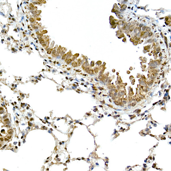 Anti-TMS1 Rabbit pAb