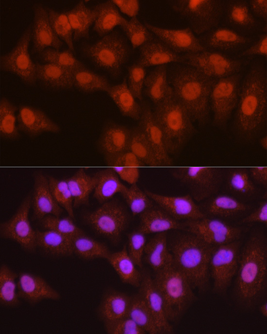 Anti-TMS1 Rabbit pAb