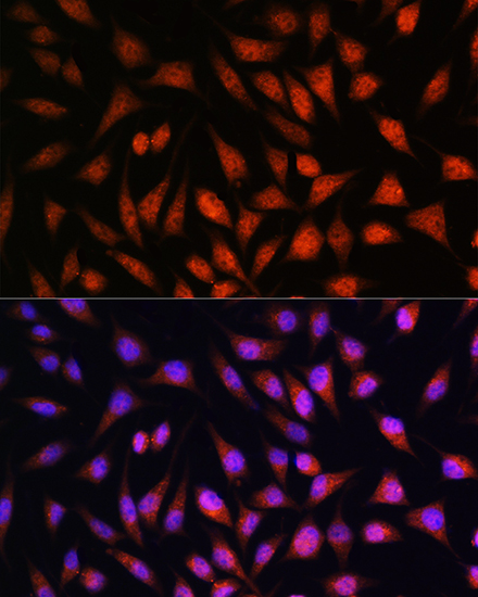 Anti-STAT1 Rabbit pAb