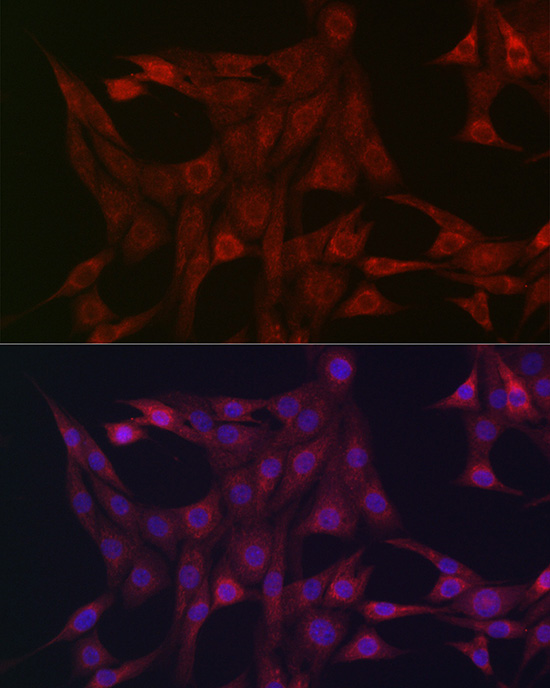 Anti-STAT3 Rabbit pAb
