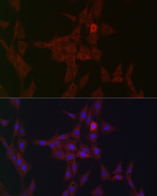 Anti-STAT3 Rabbit pAb