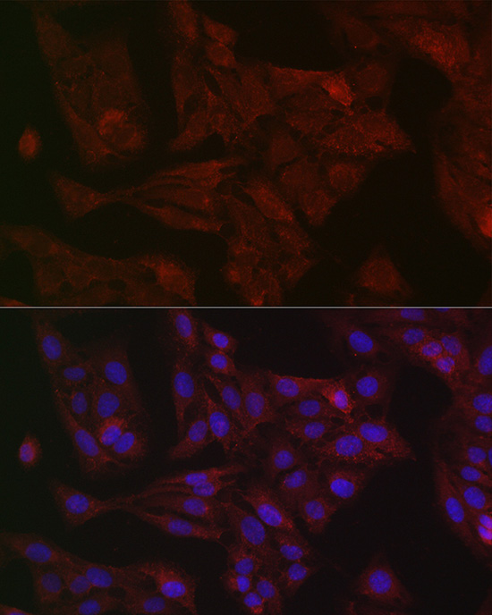 Anti-STAT3 Rabbit pAb