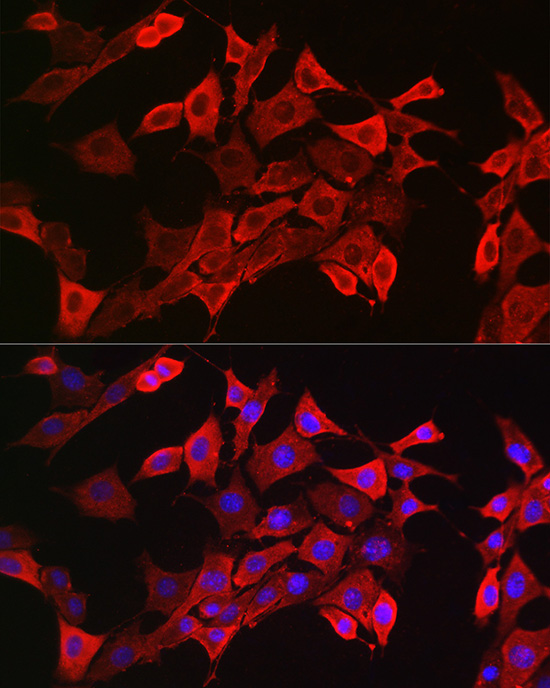 Anti-STAT3 Rabbit pAb