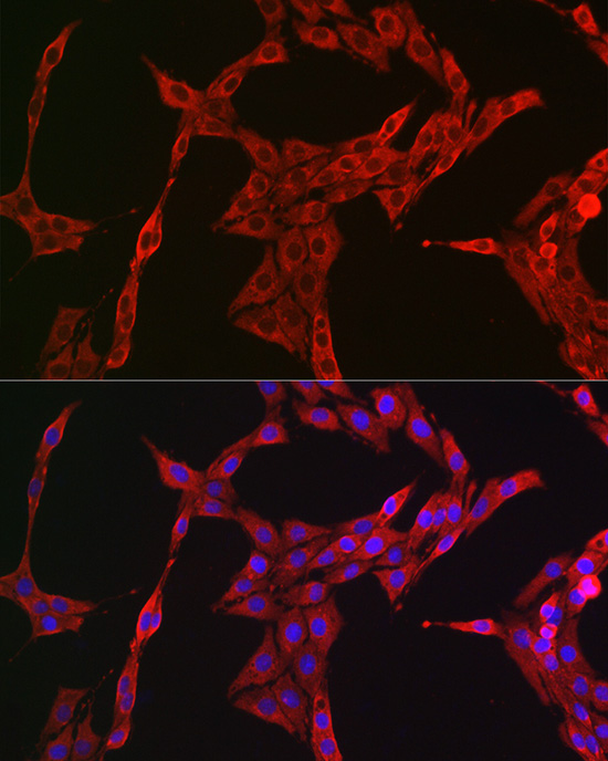 Anti-STAT3 Rabbit pAb