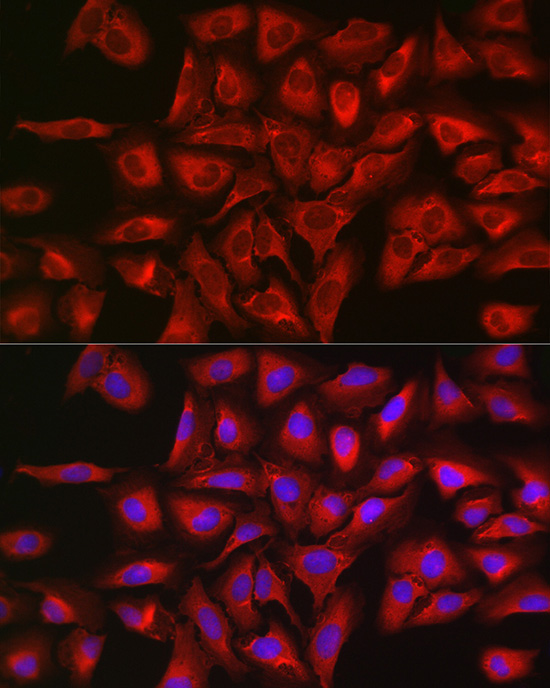 Anti-STAT3 Rabbit pAb